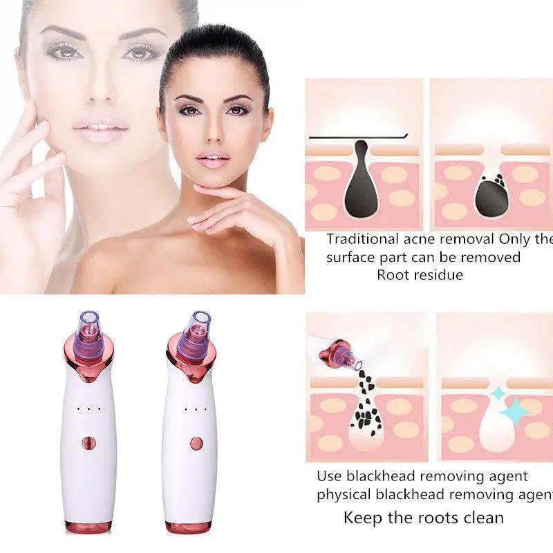 Blackhead Remover Acne Vacuum | Skin Care Tool.